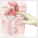 Your prostate is right here.